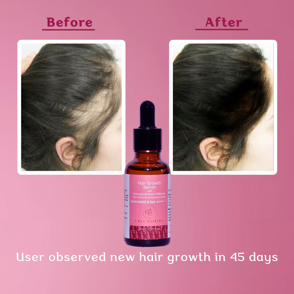 Hair Growth Serum with 3% Anagain & Redensyl, 2% Baicapil, Plant Keratin, Rice & Rosemary Extract for Anti-Hairfall, Boosts Hair growth - 30ml - ELI ELIXIR